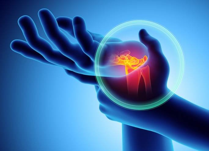 Two Conditions Often Misdiagnosed as Carpal Tunnel Syndrome